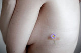 Boob jobs and mastectomies.....same same? Nope. Different.