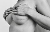 8 Simple Steps to Minimise Scarring after Surgery